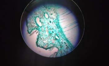 Kula ukazana w powiększeniu mikroskopowym. Na białym tle widać porowaty, zielony obszar. 